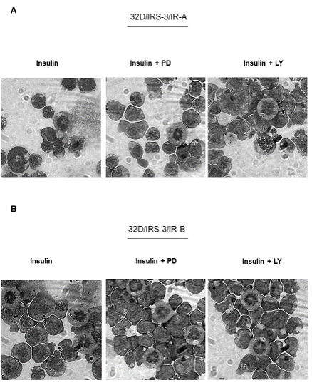 Figure 7: Effect of either ERK or PI3K inhibition on insulin stimulated differentiation of 32D-derived cells.