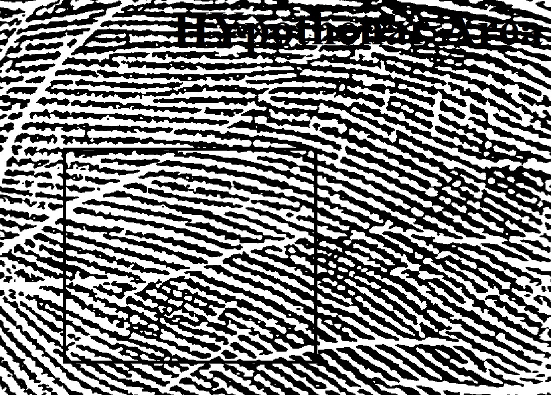 Figure 1: lower area of palm print (hypothenar area).