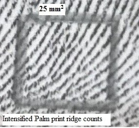 Figure 2: lower area of palm print (hypothenar area)